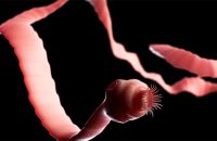 Thịt heo nhiễm sán và cách nhân viết thịt lợn nhiễm sán